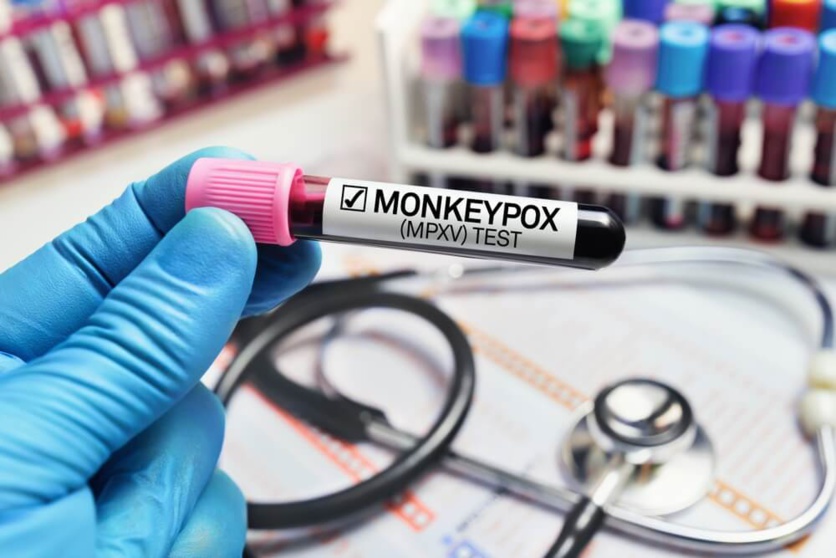 Test PCR pour la variole du singe ©Shutterstock